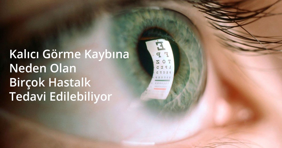 Kalıcı Görme Kaybına Neden Olan Birçok Hastalık Tedavi Edilebiliyor
